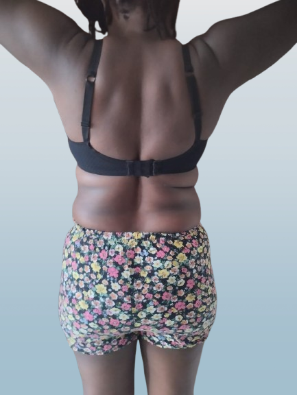 After Transformation