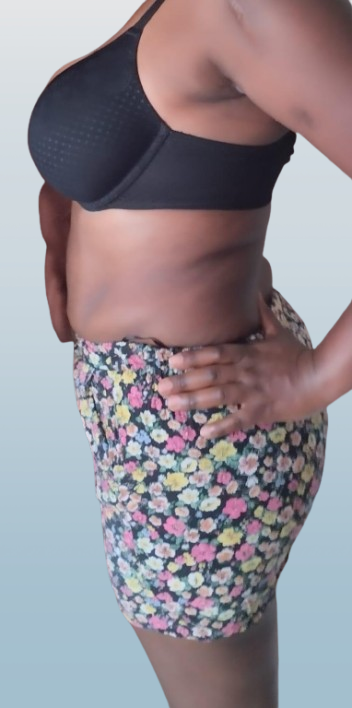 After Transformation