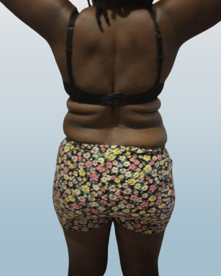 Before Transformation