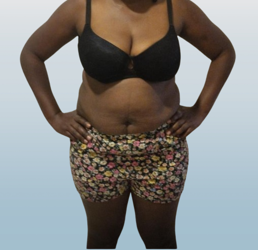 Before Transformation