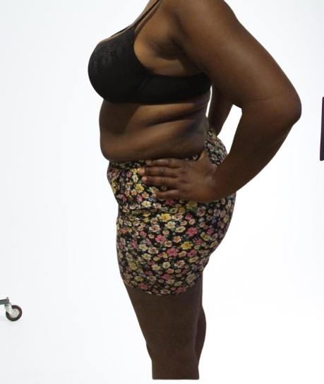 Before Transformation